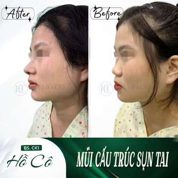 Slider image (5) Dr. Ho Co - Aesthetics and Plastic Surgery in Vietnam